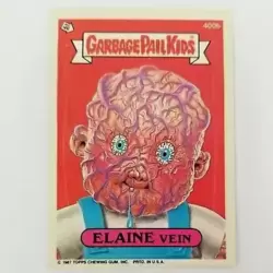 ELAINE Vein