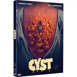 Cyst